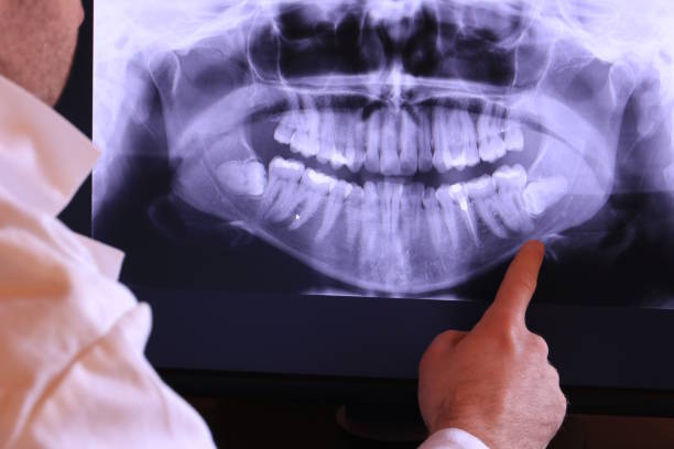Best Emergency Dental Care for Abscessed Tooth in Southmayd, TX