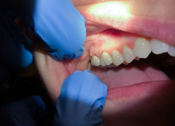 Best Mobile Emergency Dentist in Southmayd, TX